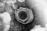 Rellevants avenços sobre la capacitat del sistema immunitari humà per fer front al citomegalovirus
