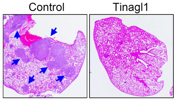 el tratamiento con proteína tinagl1 recombinante suprimió significativamente la metástasis pulmonar, como muestran las flechas azules en las imágenes correspondientes a ratones con (derecha) y sin (izquierda) tratamiento con tinagl1   Créditos: imagen cortesía de yibin kang y col., universidad de princeton